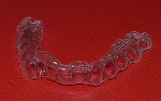 Best Braces Treatment in Pune with Invisalign Invisalign in Pune