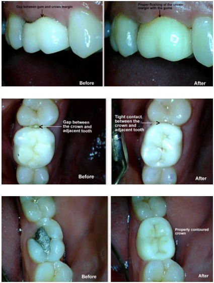 Dentist in Pimple Saudagar Dentist in Pimple Saudagar