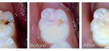 General Dentistry