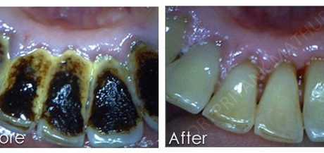 General Dentistry