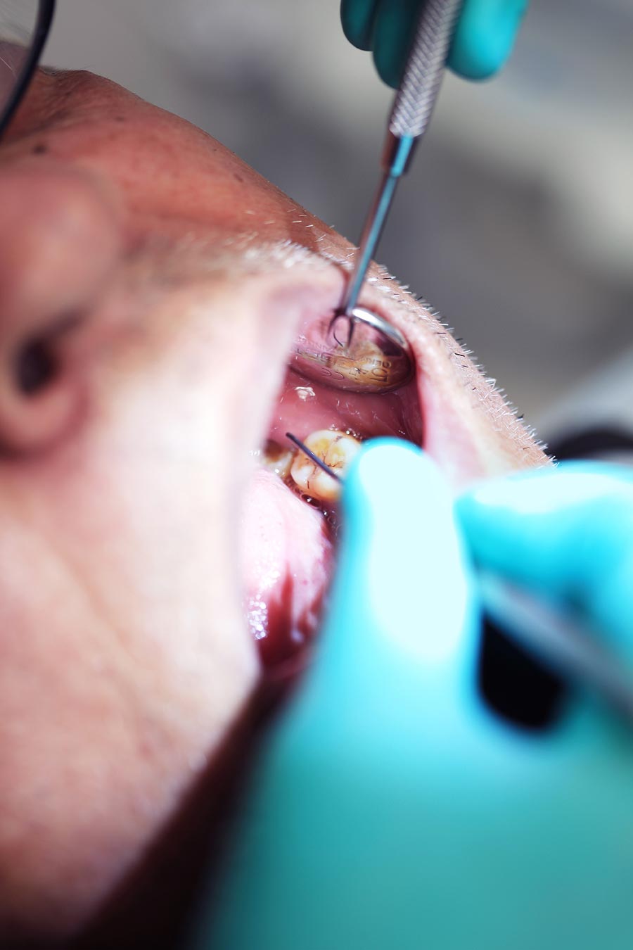 Dental Emergency