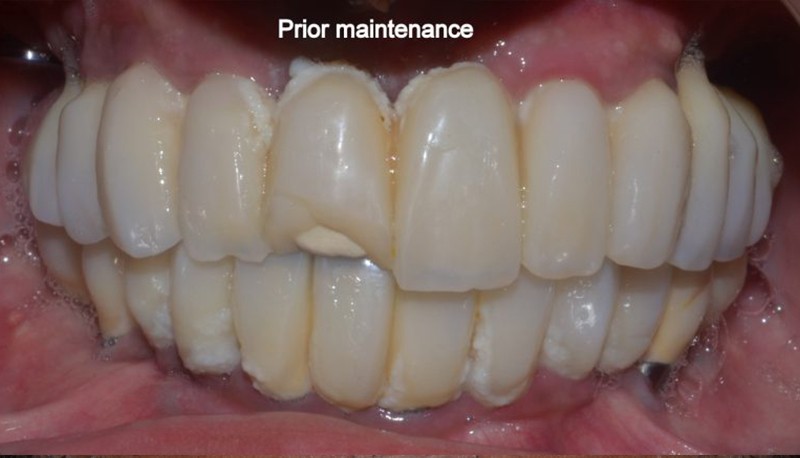 02-prior-maintainance