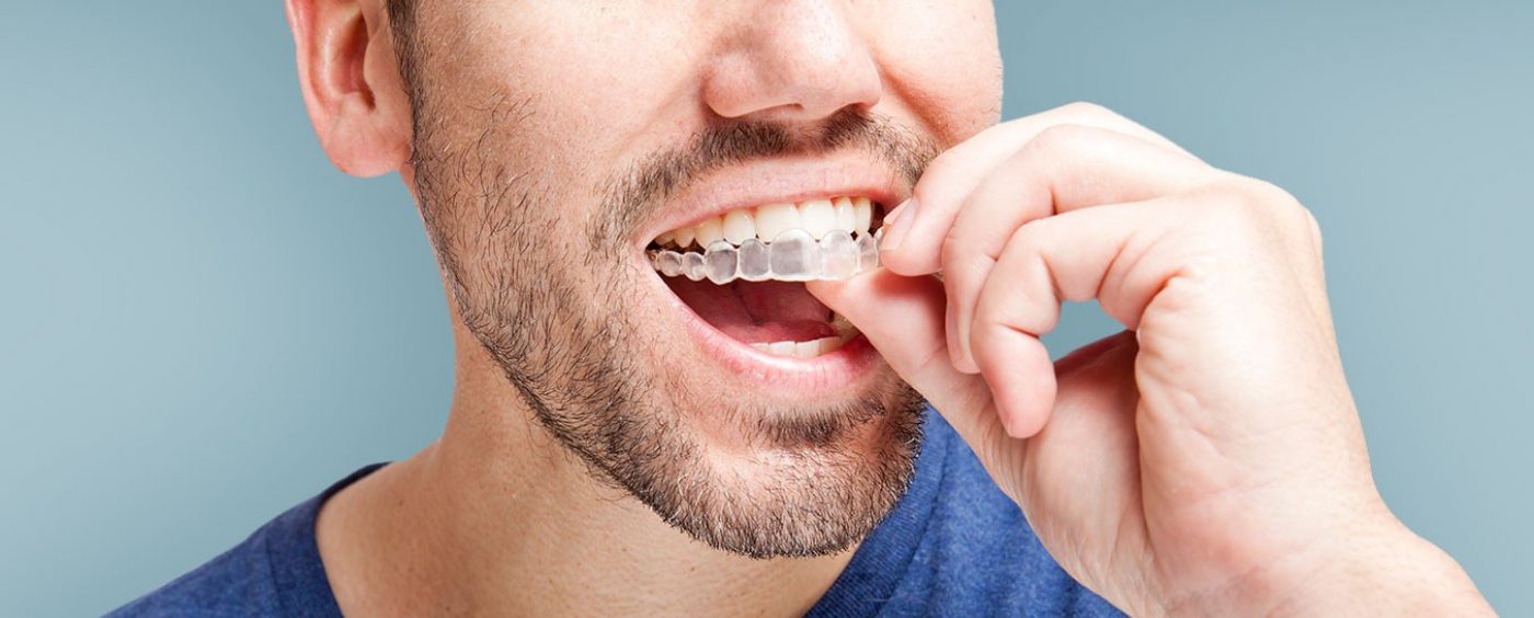 Considering straighter teeth? Invisaligns can save the day!