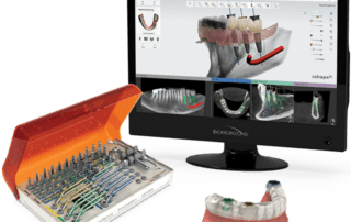 Biohorizons dental implants