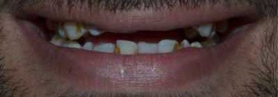 Before