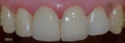 After