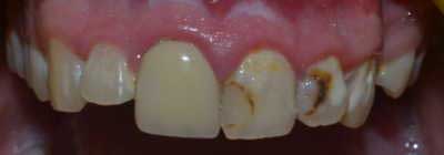 Before