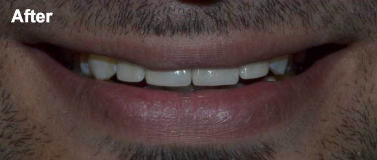 After