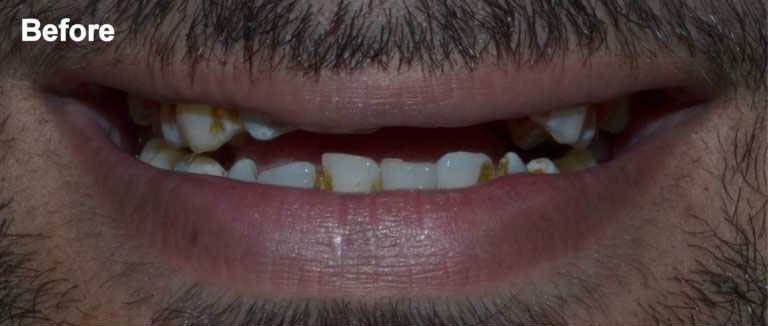 Before