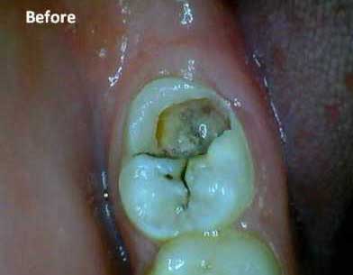 Before