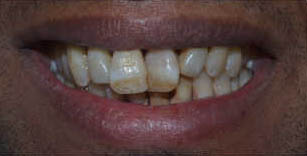 Before