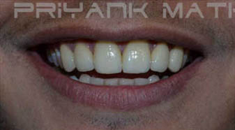 After