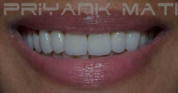 After