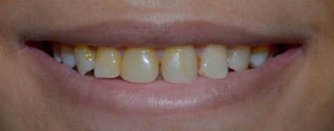 Before