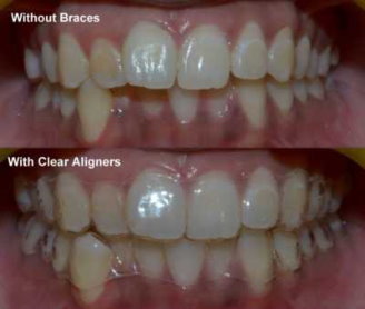 Best Orthodontists in Pune Best Orthodontists in Pune