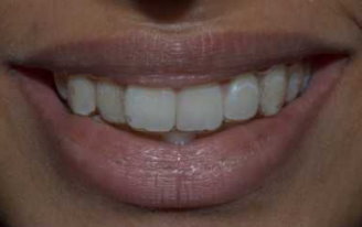 Orthodontist in Pune Orthodontist in Pune