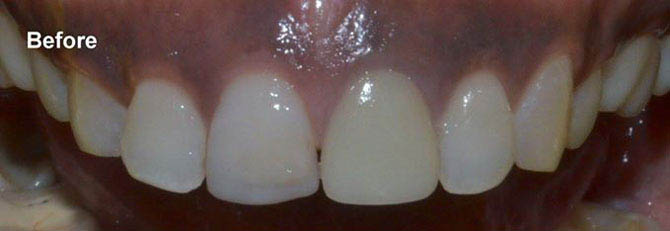Before