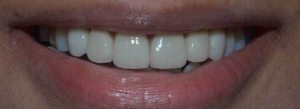 After