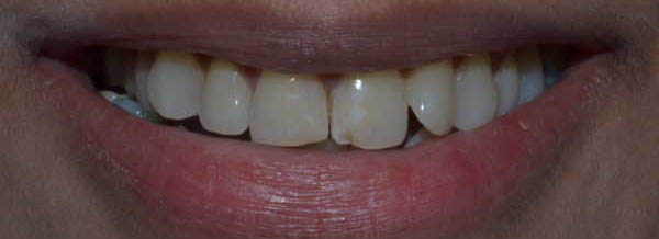 Before